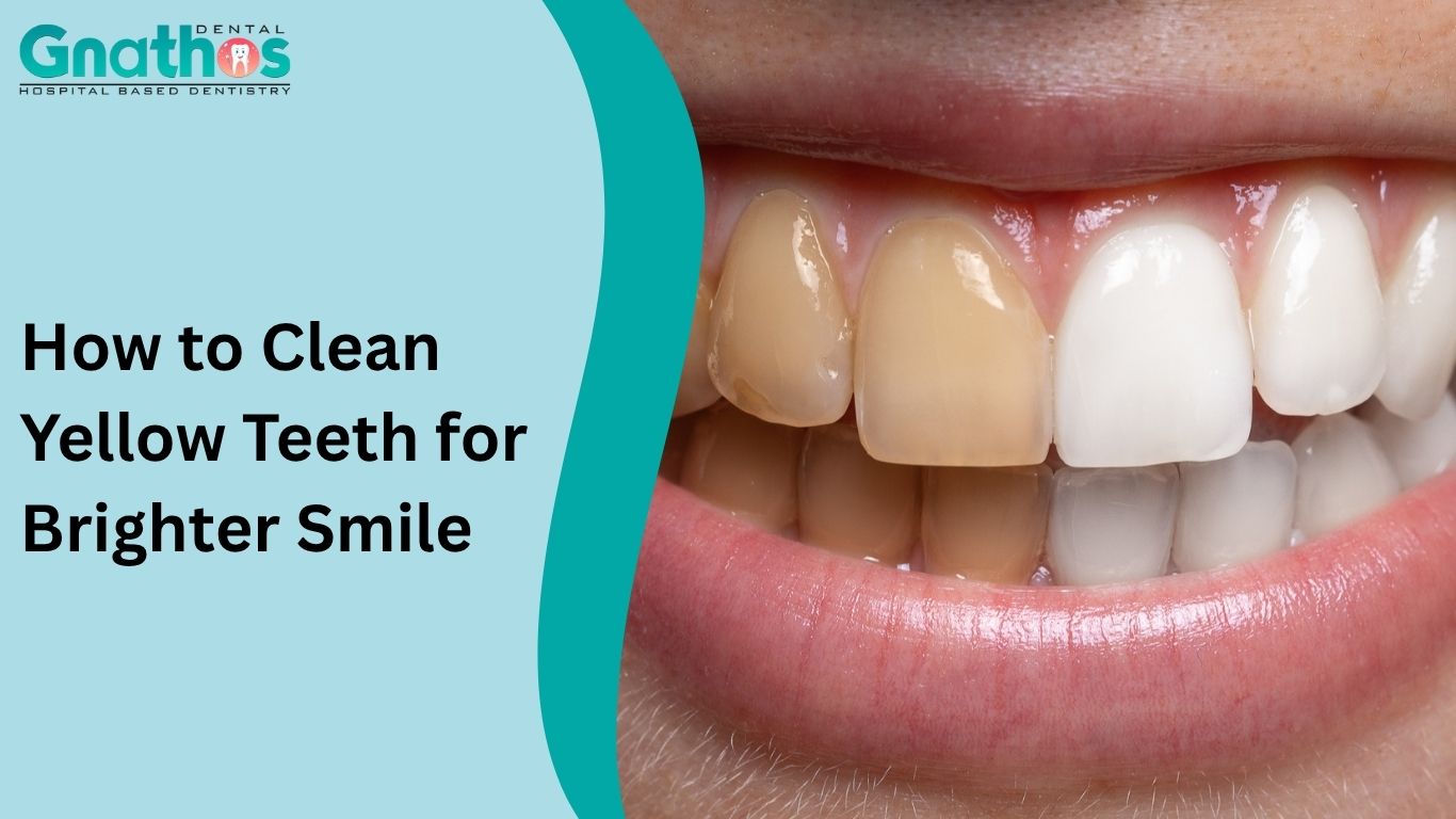 How to Clean Yellow Teeth