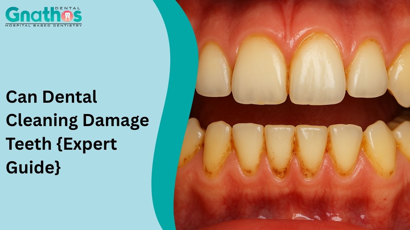 Can Dental Cleaning Damage Teeth