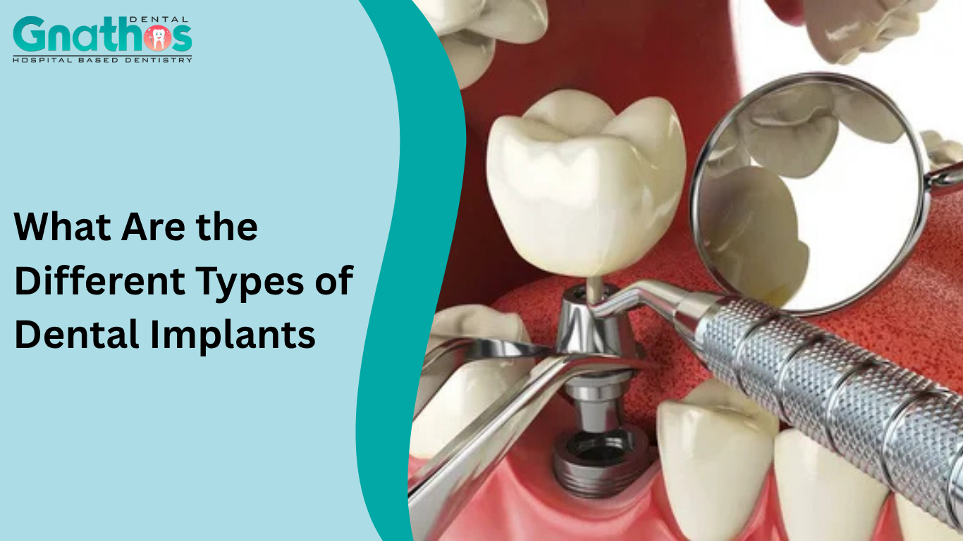 Types of Dental Implants